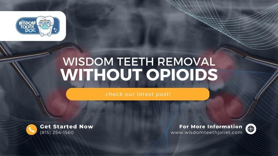 Wisdom teeth removal by Dr. James Babiuk